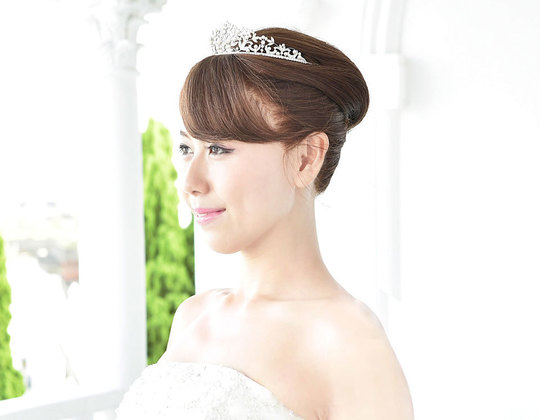 諦めなくていい。生え際が出せる医療用ウィッグで結婚式